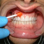 Step 2: Oral/Tongue Laceration/Trauma